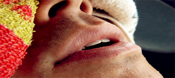 Sleep Apnea symptoms